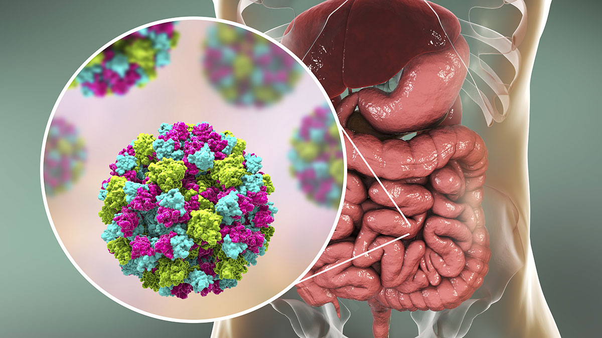 Coronavirus SARS-CoV-2 infects cells of the intestine