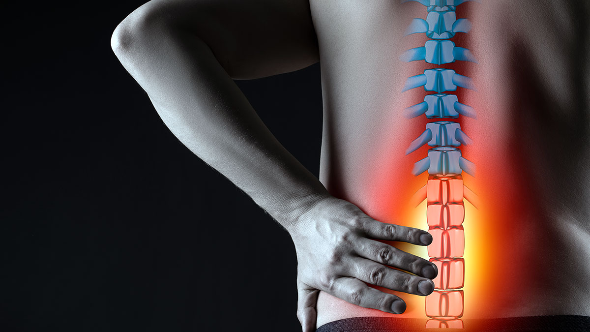 Leczenie bólu kręgosłupa. Steroidy i małoinwazyjne zabiegi ambulatoryjne. Cz. 2. 