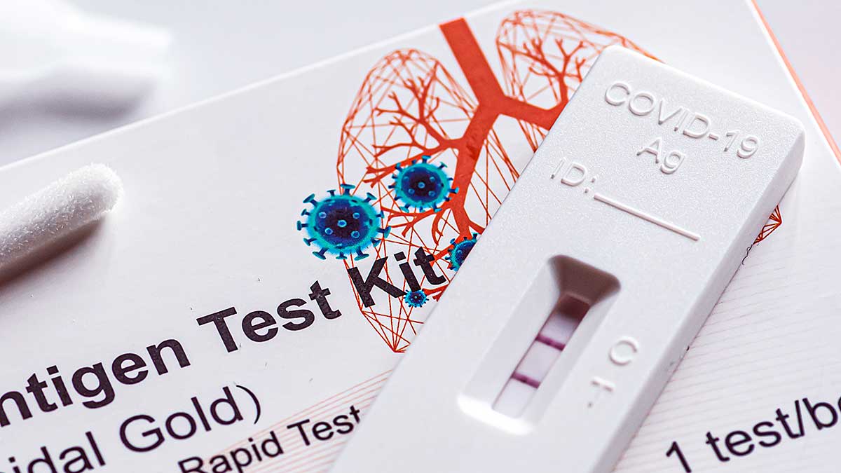 Można już zamawiać darmowe domowe testy na koronawirusa