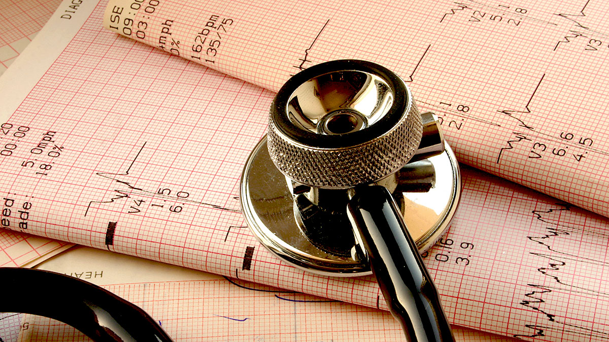 The Basics of Heart Rhythm Disorders: Understanding Your Heart's Electrical System